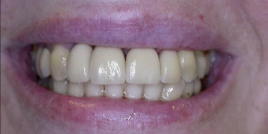 After: Comprehensive smile treatment