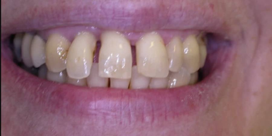 Before: Comprehensive smile treatment